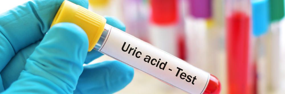 guta- test acid uric
